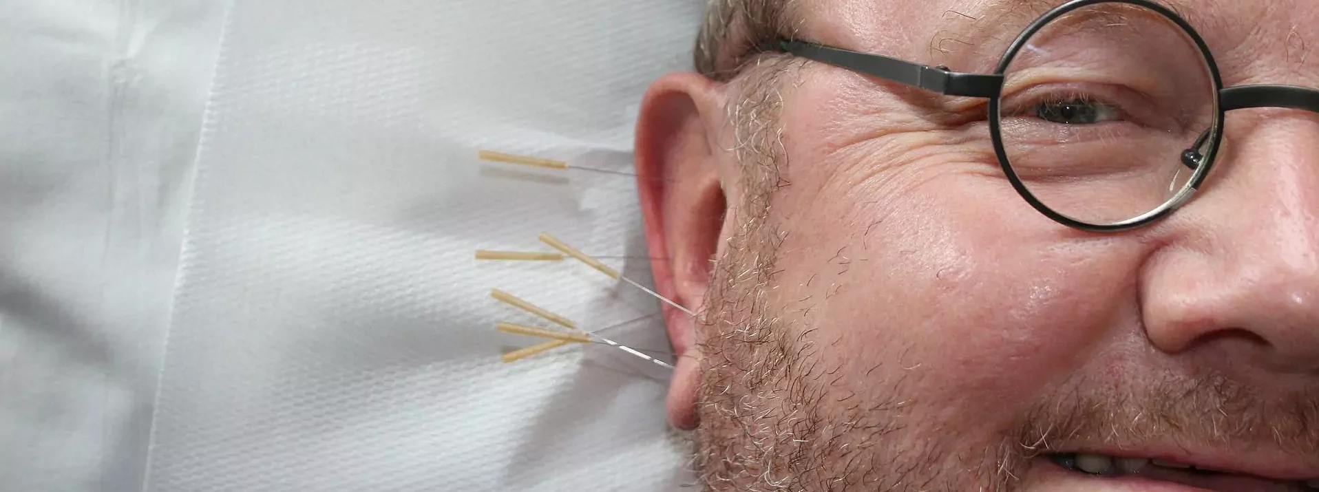 Acupuncture Moncton