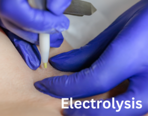 Electrolysis - Permanent Hair Removal